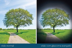 visão_normal-e-com-glaucoma-avançado_