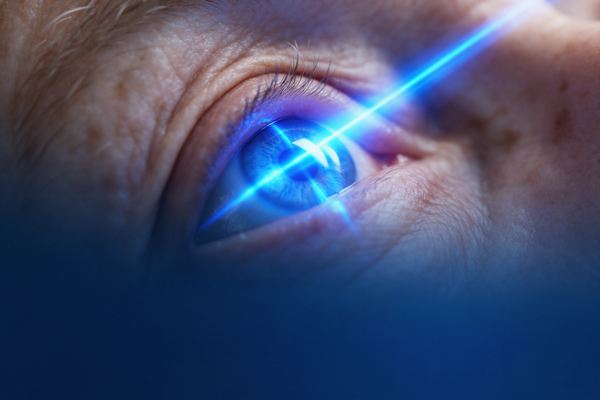 Cirurgia de catarata com laser de femtossegundo: como funciona no Hospital de Olhos de Blumenau